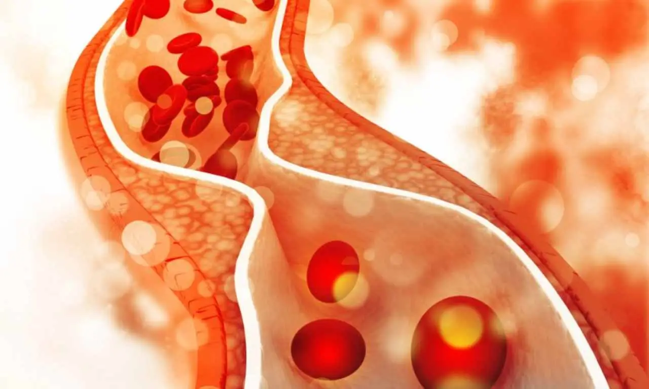 Colesterolo alto: gli alimenti da evitare assolutamente Immagine selezionata
